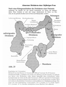 Kopfschmerzen beseitigen; Neurodermitis beseitigen; Colon-hydro-für-zuhause