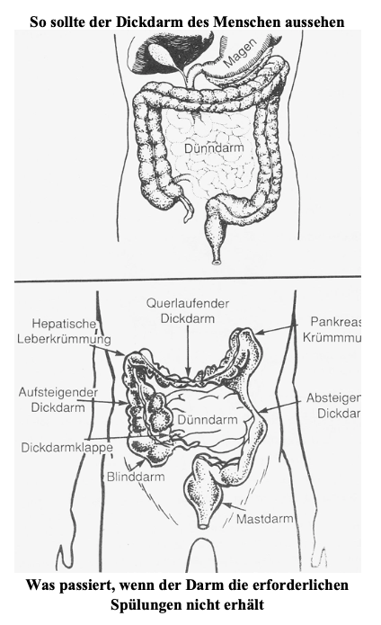 Kopfschmerzen beseitigen; Neurodermitis beseitigen; Colon-hydro-für-zuhause